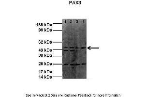 Lanes:   Lane1: 20ug RH30 lysate Lane2: 20ug RH30 lysate Lane3: 20ug RH41 lysate Lane4: 20ug RH41 lysate  Primary Antibody Dilution:   1:1000  Secondary Antibody:    Donkey anti-rabbit HRP  Secondary Antibody Dilution:   1:4000  Gene Name:   PAX3  Submitted by:   Dr Joanna Selfe, Institute of Cancer Research (Paired Box 3 抗体  (N-Term))