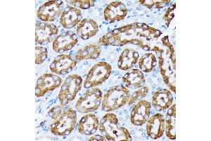Immunohistochemistry (IHC) image for anti-Cytochrome P450, Family 4, Subfamily A, Polypeptide 11 (CYP4A11) antibody (ABIN7266658)