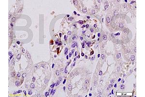 Formalin-fixed and paraffin embedded mouse kidney tissue labeled Anti-Mouse IgA Polyclonal Antibody, Unconjugated (ABIN673041) at 1:200, followed by conjugation to the secondary antibody and DAB staining
