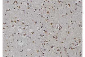 ABIN6279367 at 1/100 staining Human brain tissue by IHC-P. (ZNRD1 抗体  (Internal Region))