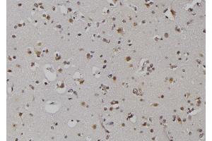 ABIN6279367 at 1/100 staining Human brain tissue by IHC-P. (ZNRD1 抗体  (Internal Region))
