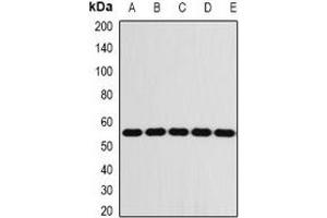 Western blot analysis of FKBP8 expression in Jurkat (A), THP1 (B), mouse liver (C), mouse eye (D), rat brain (E) whole cell lysates.