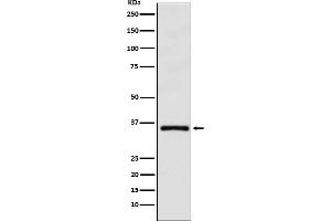 Western blot analysis of DMRT1 expression in HL-60 cell lysate.