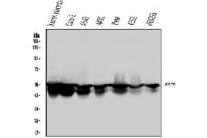 Western blot analysis of Cytokeratin 8 using anti-Cytokeratin 8 antibody (ABIN6719478). (KRT8 抗体  (AA 107-325))