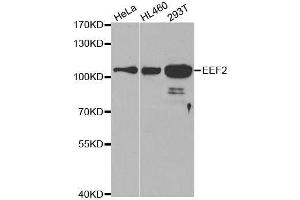 Western blot analysis of extracts of various cell lines, using EEF2 antibody. (EEF2 抗体  (AA 1-290))