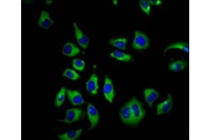 Immunofluorescence staining of A549 cells with ABIN7148830 at 1:66, counter-stained with DAPI. (GARP 抗体  (AA 131-253))