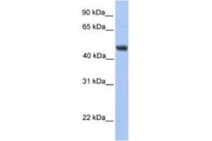 Western Blotting (WB) image for anti-Asparagine-Linked Glycosylation 2, alpha-1,3-Mannosyltransferase Homolog (ALG2) antibody (ABIN2463245) (ALG2 抗体)