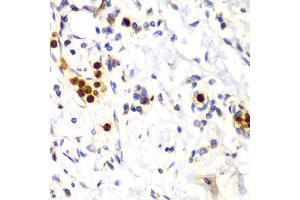 Immunohistochemistry of paraffin-embedded human esophagus using S100A12 antibody (ABIN6291358) at dilution of 1:100 (40x lens). (S100A12 抗体)