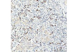 IHC analysis of Chromogranin A/CHGA using anti-Chromogranin A/CHGA antibody (ABIN7600415).