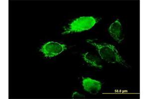 Immunofluorescence of purified MaxPab antibody to KCNIP2 on HeLa cell. (KCNIP2 抗体  (AA 1-270))
