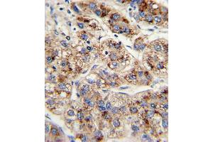 Immunohistochemistry (IHC) image for anti-Enoyl-CoA, Hydratase/3-Hydroxyacyl CoA Dehydrogenase (EHHADH) antibody (ABIN3003844) (EHHADH 抗体)