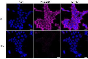 Immunocytochemical staining of HeLa cells using IKK alpha antibody (ABIN7798146), 1:1,000), Top panel: wild-type (WT), Bottom panal: IKK alpha shRNA knockdown (KD). (Recombinant IKK alpha 抗体)
