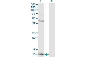 Western Blot analysis of CCL2 expression in transfected 293T cell line by CCL2 monoclonal antibody (M12), clone 4B12. (CCL2 抗体  (AA 1-99))