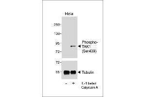 Western blot analysis of lysates from Hela cell line, untreated or treated with IL-1beta(20 ng/mL) +Calyculin A(100 nM), using  (upper) or Tubulin (lower). (TR4 抗体  (pSer439))