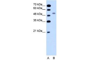 SLC12A1 antibody used at 1 ug/ml to detect target protein. (SLC12A1 抗体)