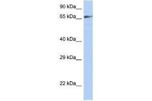 ZNF676 antibody used at 0. (ZNF676 抗体  (Middle Region))
