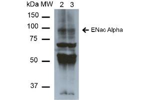 Western Blot analysis of Mouse Whole kidney homogenates showing detection of ~85kDa ENaC alpha protein using Mouse Anti-ENaC alpha Monoclonal Antibody, Clone 2G4 . (SCNN1A 抗体  (AA 46-68) (Atto 390))