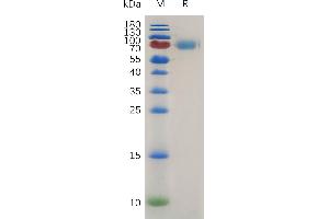 SDS-PAGE (SDS) image for Interleukin 2 Receptor, alpha (IL2RA) (AA 22-236) protein (Fc Tag) (ABIN7491125)