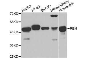 Western blot analysis of extract of various cells, using REN antibody. (Renin 抗体)