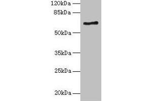 Western blot All lanes: ALAS2 antibody at 6 μg/mL + K562 whole cell lysate Secondary Goat polyclonal to rabbit IgG at 1/10000 dilution Predicted band size: 65, 61, 50, 64 kDa Observed band size: 65 kDa (ALAS2 抗体  (AA 50-587))