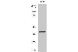 Western Blotting (WB) image for anti-MEF2BNB-MEF2B Readthrough (MEF2BNB-MEF2B) (Internal Region) antibody (ABIN3185512) (MEF2BNB-MEF2B Readthrough (MEF2BNB-MEF2B) (Internal Region) 抗体)