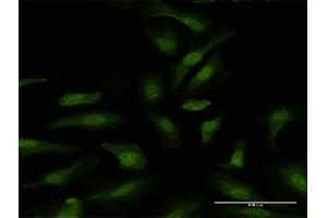 Immunofluorescence of purified MaxPab antibody to DDX6 on HeLa cell.