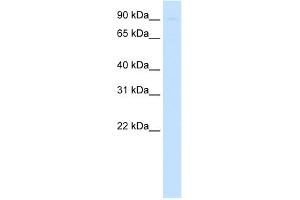 WB Suggested Anti-SIRT1 Antibody   Titration: 0. (SIRT1 抗体  (N-Term))
