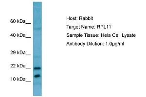 Western Blotting (WB) image for anti-Ribosomal Protein L11 (RPL11) (C-Term) antibody (ABIN2789802) (RPL11 抗体  (C-Term))