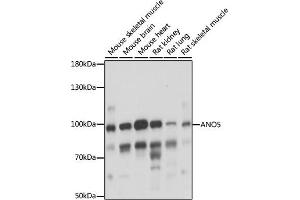 Western blot analysis of extracts of various cell lines, using  antibody (ABIN7265626) at 1:1000 dilution. (Anoctamin 5 抗体  (AA 1-300))