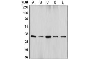 Western blot analysis of DFF45 expression in HeLa (A), U937 (B), WR19L (C), HEK293T (D), Jurkat (E) whole cell lysates.