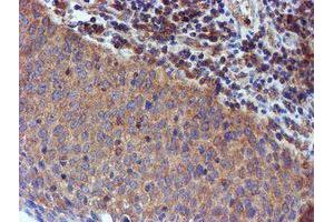 Image no. 5 for anti-Iduronate 2-Sulfatase (IDS) antibody (ABIN1498798)