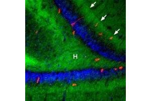 Immunohistochemistry (IHC) image for anti-Adrenergic, beta-3-, Receptor (ADRB3) (AA 180-192), (C186S), (Extracellular) antibody (ABIN7042907)