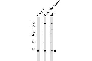Western Blotting (WB) image for anti-ATP Synthase, H+ Transporting, Mitochondrial F1 Complex, epsilon Subunit (ATP5E) (AA 21-51) antibody (ABIN6242172)