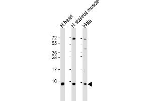 All lanes : Anti-ATP5E Antibody (C-Term) at 1:2000 dilution Lane 1: human heart lysate Lane 2: human skeletal muscle lysate Lane 3: Hela whole cell lysate Lysates/proteins at 20 μg per lane. (ATP5E 抗体  (AA 21-51))