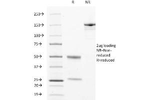 SDS-PAGE Analysis Purified CD63 Mouse Monoclonal Antibody (529). (CD63 抗体)