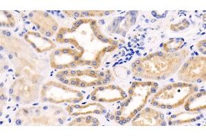 Immunohistochemistry (IHC) image for anti-Induced Myeloid Leukemia Cell Differentiation Protein Mcl-1 (MCL1) (AA 2-307) antibody (ABIN7440890)