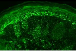 Immunohistochemistry analysis using Rabbit Anti-Cpn10 Polyclonal Antibody (ABIN361677 and ABIN361678). (HSPE1 抗体  (AA 91-101))