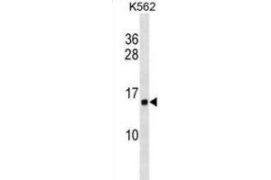 Western Blotting (WB) image for anti-Histone Cluster 1, H2ab (HIST1H2AB) antibody (ABIN2999462) (HIST1H2AB 抗体)
