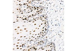 Immunohistochemistry of paraffin-embedded human esophagus using PCNA antibody (ABIN6133630, ABIN6139020, ABIN6139022 and ABIN7101400) at dilution of 1:2700 (40x lens). (PCNA 抗体)