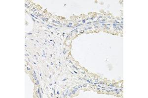 Immunohistochemistry of paraffin-embedded human prostate using EPOR antibody. (EPOR 抗体)