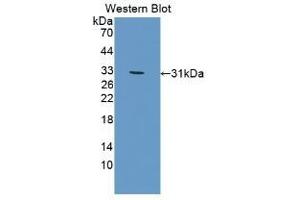 Detection of recombinant BMX using Polyclonal Antibody to BMX Non Receptor Tyrosine Kinase (BMX) (BMX 抗体  (AA 209-446))