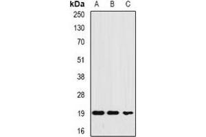 Western blot analysis of Ferritin L expression in HEK293T (A), MCF7 (B), HepG2 (C) whole cell lysates. (Ferritin L 抗体)