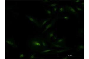 Immunofluorescence of monoclonal antibody to ESR1 on HeLa cell. (Estrogen Receptor alpha 抗体  (AA 41-140))