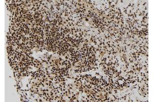 ABIN6272905 at 1/100 staining Human spleen tissue by IHC-P. (RBM15 抗体  (N-Term))