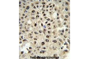 Immunohistochemistry (IHC) image for anti-Sjogren Syndrome Antigen B (SSB) antibody (ABIN3001636) (SSB 抗体)
