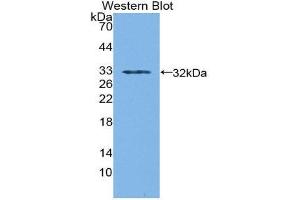 Western Blotting (WB) image for anti-Sorbitol Dehydrogenase (SORD) (AA 98-355) antibody (ABIN1870684) (SORD 抗体  (AA 98-355))