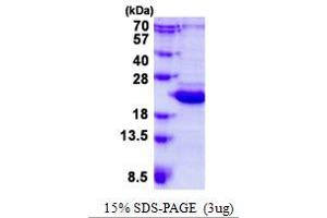 Image no. 1 for BCL2-Like 10 (Apoptosis Facilitator) (BCL2L10) protein (His tag) (ABIN1098488) (BCL2L10 Protein (His tag))