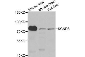 Western blot analysis of extracts of various cell lines, using KCND3 antibody. (KCND3 抗体)
