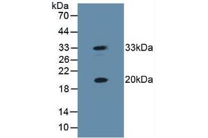 Western blot analysis of Mouse Skeletal Muscle Tissue. (HSPB2 抗体  (AA 12-182))