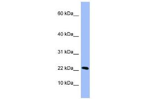 PIN4 antibody used at 1 ug/ml to detect target protein. (PIN4 抗体  (Middle Region))
